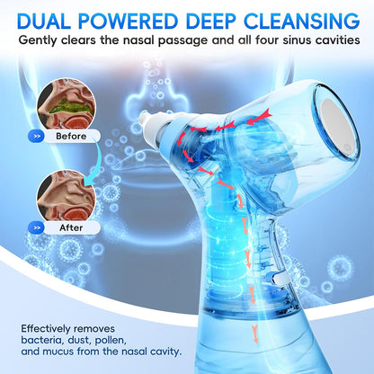 Cleanse® - Nasal Irrigation System
